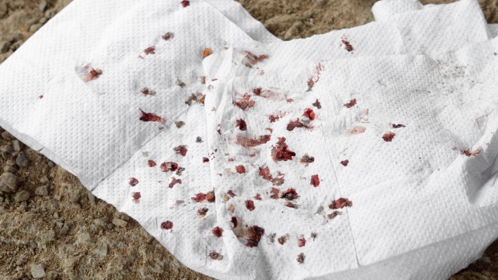 Aj keď domáce a prírodné metódy môžu byť účinné pri miernych alebo začiatočných infestáciách blchami, existujú situácie, keď je potrebné obrátiť sa na odborníkov. 