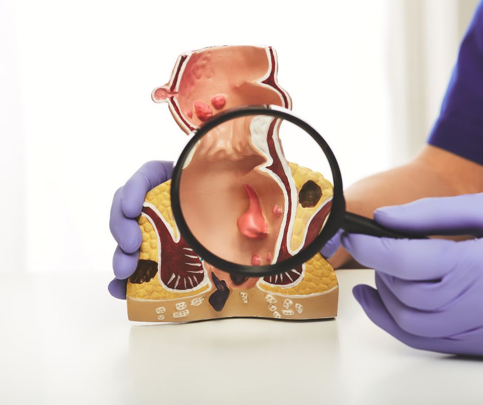 Keď tieto cievy podliehajú nadmernému tlaku, môžu sa rozšíriť a spôsobiť rôzne symptómy