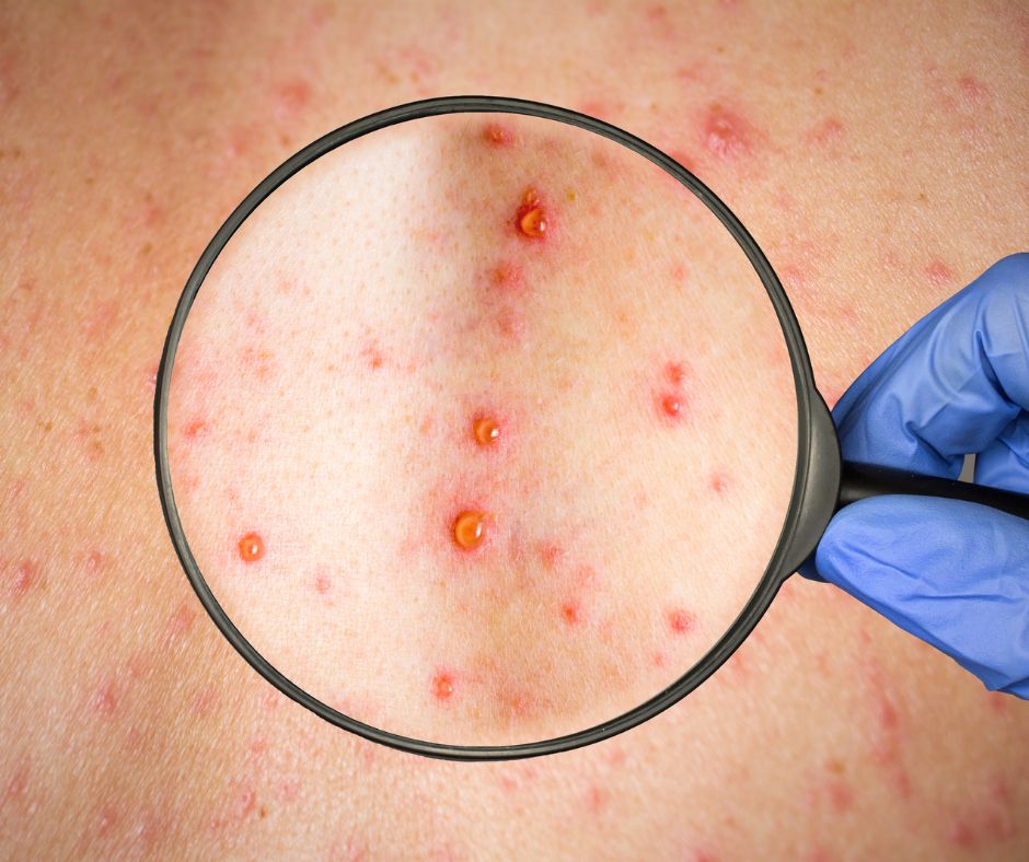 Jednym z najcharakteristickejsich priznakov ovcich kiahni je vyrazka