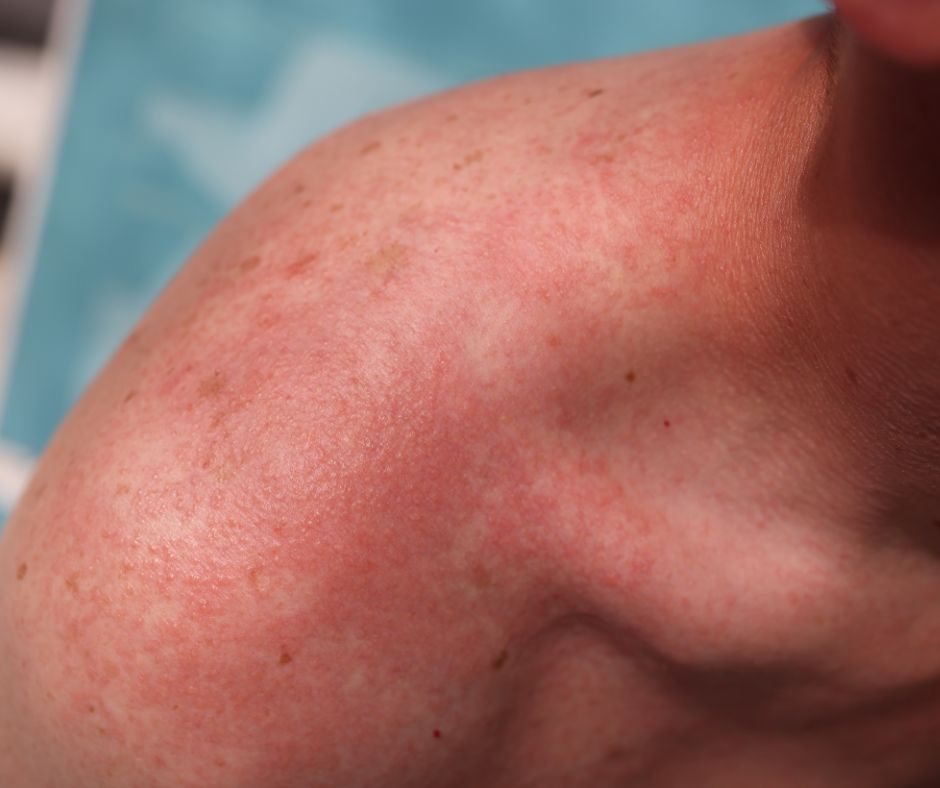 Ked sa organizmus prehreje potne zlazy zacnu produkovat viac potu na regulaciu teploty tela