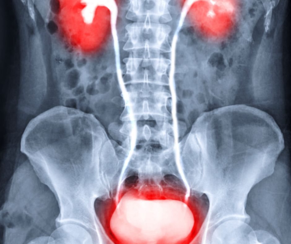 Mocove cesty tvoria dolezity system v tele ktory zabezpecuje tvorbu zhromazdovanie a vylucovanie mocu z organizmu