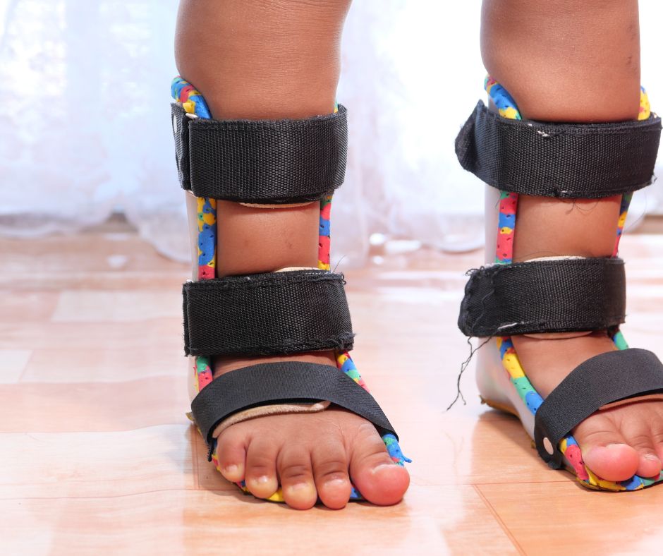 Okrem standardnych ortopedickych papuc existuju aj specializovane ortopedicke papuce ktore su navrhnute pre riesenie konkretnych problemov chodidiel