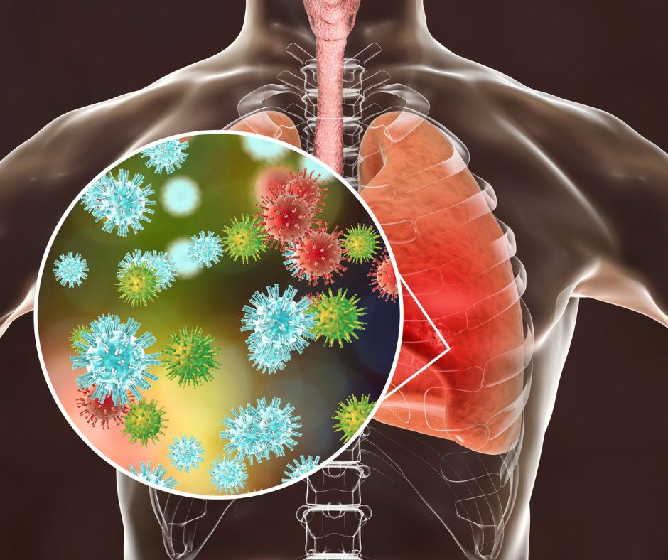 Ovcie kiahne su sposobene virusom varicella zoster ktory patri do skupiny herpesvirusov