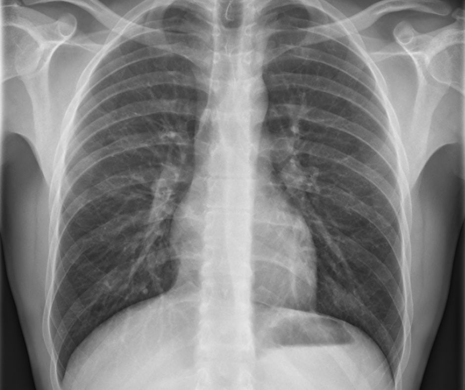 Priedusky su klucovou sucastou nasho dychacieho systemu su to velke trubice ktore vedu vzduch do a z pluc