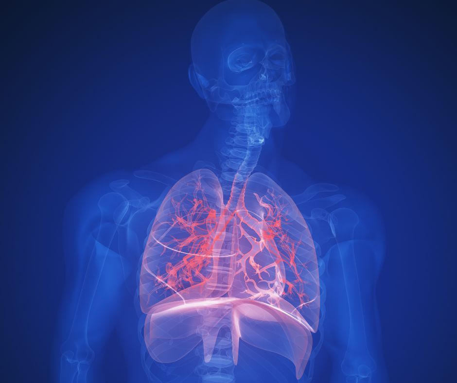 Z&aacute;pal p&lcaron;&uacute;c: Pr&iacute;&ccaron;iny, pr&iacute;znaky, diagnostika a lie&ccaron;ba