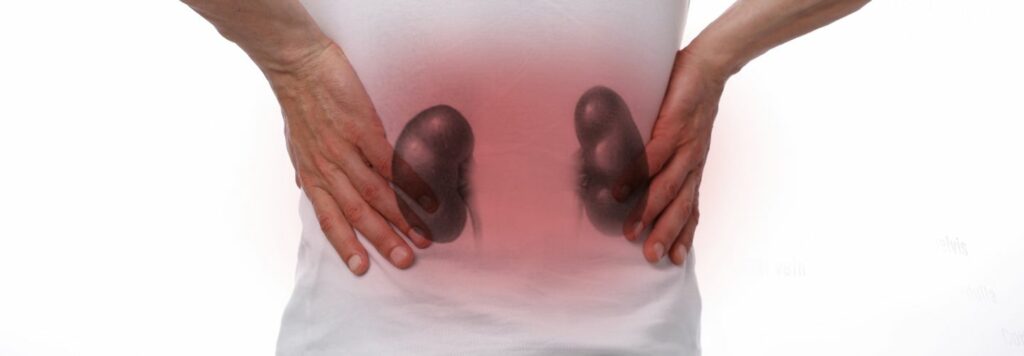 Boles&tcaron; obli&ccaron;ky: Pr&iacute;&ccaron;iny, pr&iacute;znaky a lie&ccaron;ba