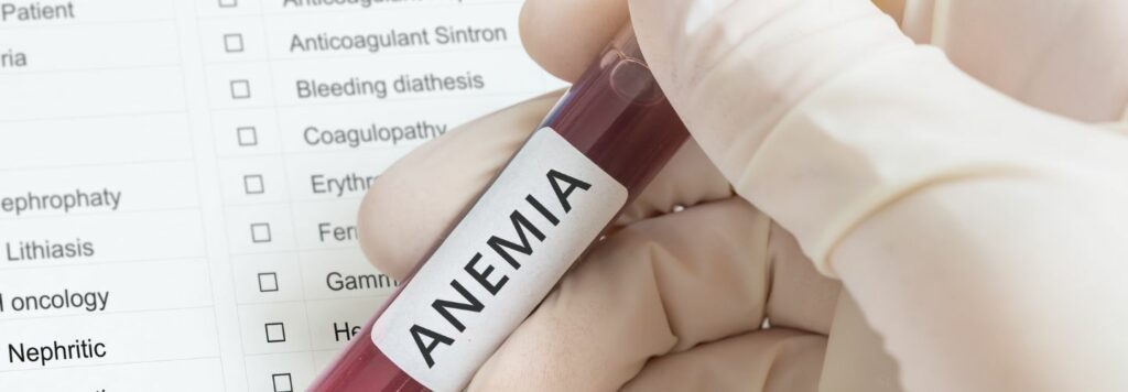 Chudokrvnos&tcaron;: Pr&iacute;&ccaron;iny, lie&ccaron;ba a prevencia