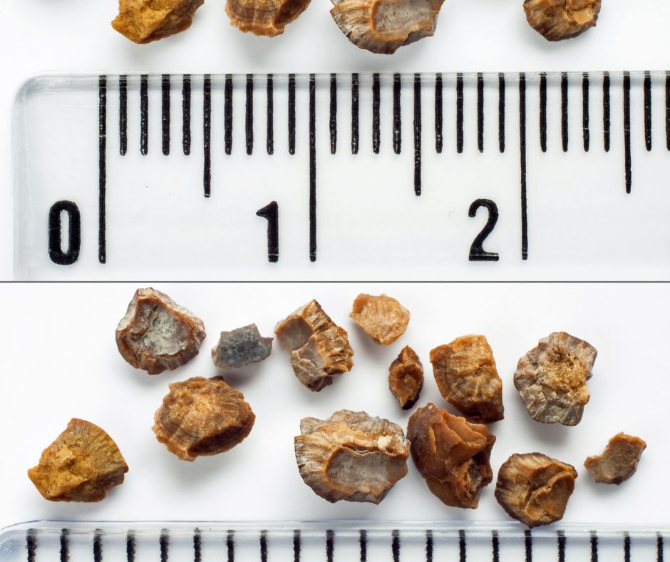 Ich tvorba je dosledkom hromadenia urcitych latok najma mineralov a soli v moci