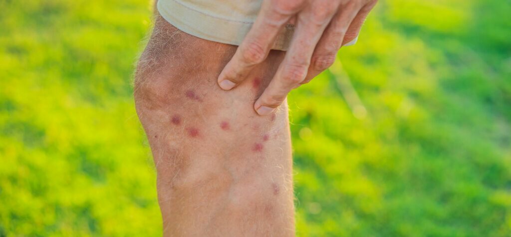 &Ccaron;erven&yacute; ohrani&ccaron;en&yacute; flak na nohe &ndash; &ccaron;o to m&ocirc;&zcaron;e by&tcaron;?