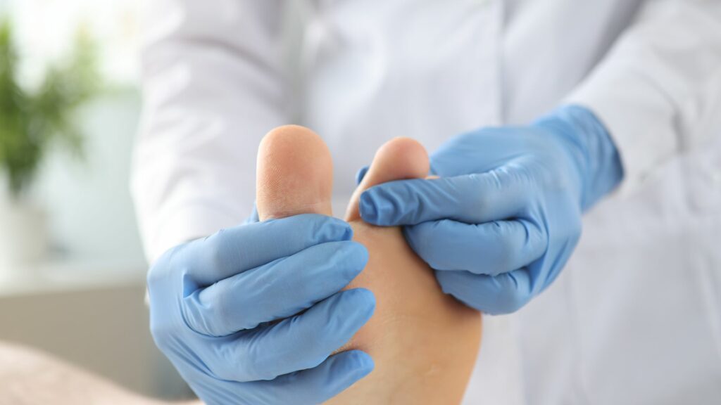 Popraskan&aacute; ko&zcaron;a medzi prstami na noh&aacute;ch &ndash; 5 d&ocirc;le&zcaron;it&yacute;ch inform&aacute;ci&iacute;