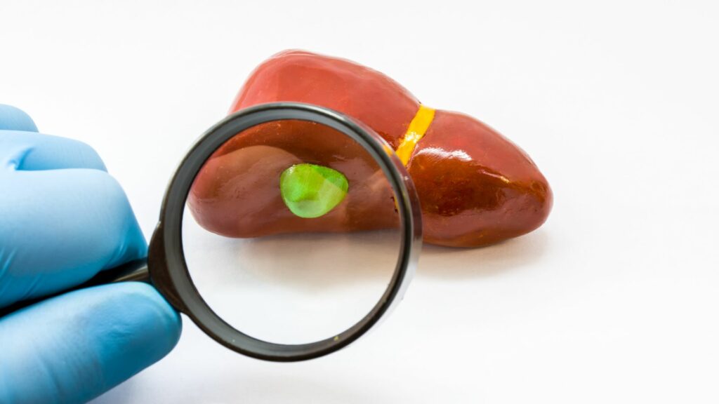 Ako vyčistiť žlčník – 5 super tipov