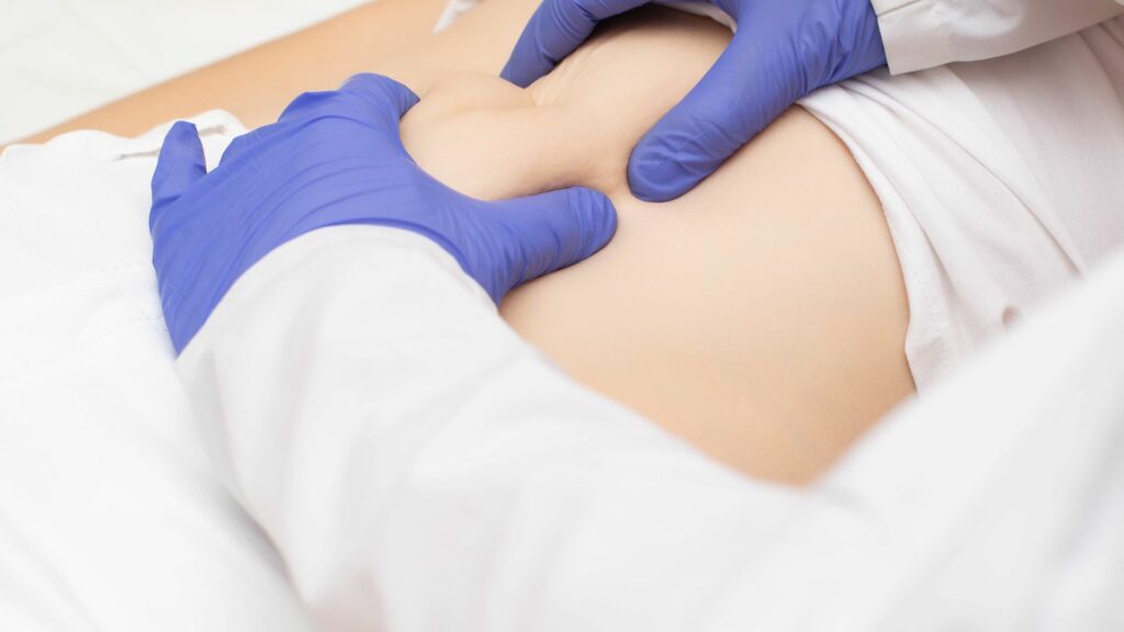 Operácia pruhu – 7 dôležitých informácií