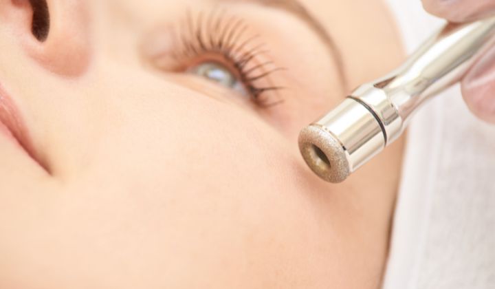 Mikrodermábrazia je nechirurgický zákrok, ktorý jemne odstraňuje hornú vrstvu pokožky (epidermis), čím odhaľuje novšiu a zdravšiu vrstvu pokožky.