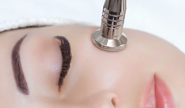 Mikrodermabrázia je populárny kozmetický zákrok vhodný pre mnoho ľudí, ale nie je to najlepšia voľba pre každého.