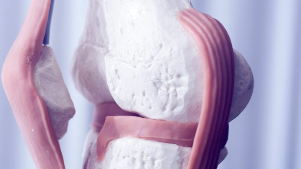 Poškodenie meniskusu môže mať rôzne príznaky a závažnosť týchto príznakov sa môže líšiť.